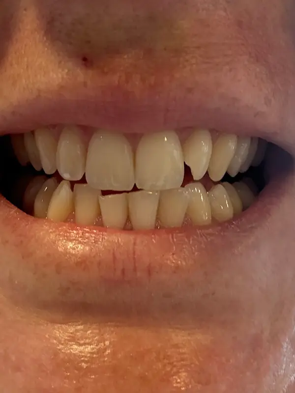 AB Dental Clinic Phuket, photo 5